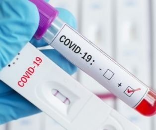 Новите случаи на COVID-19 са под 10%